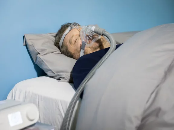 Sleep apnea male patient (sleeping) 9